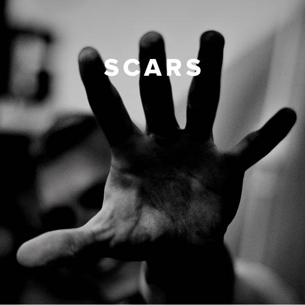 Sheet Music, Chords, & Multitracks for Worship Songs about Scars